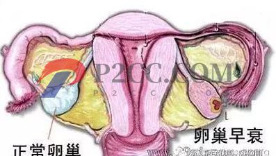 女人做了試管嬰兒人就廢了？好可怕，真的嗎？(圖2)