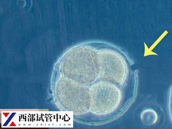 胚胎冷凍技術(shù)是輔助生殖技術(shù)的衍生技術(shù)