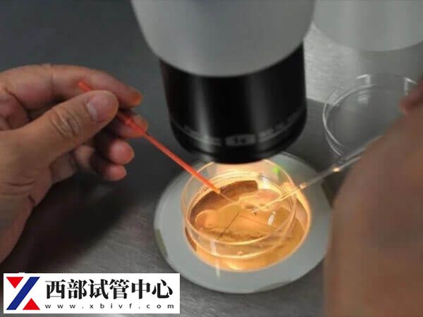 試管移植又稱體外受精-胚胎移植
