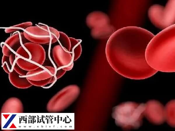 長期臥床容易形成靜脈血栓
