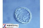 囊胚解凍后移植時(shí)間盤(pán)點(diǎn)，另附凍囊胚移植的